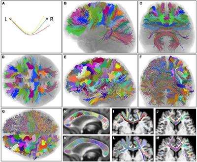 Topological arrangement of coronal segments in human callosal fibers in vivo tractography